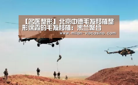 【名医整形】北京中德毛发移植整形徐霞的毛发移植:米兰聚合(图3) 米兰聚合