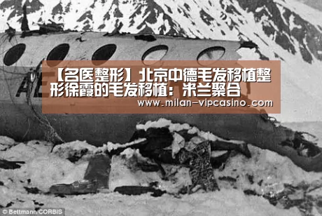 【名医整形】北京中德毛发移植整形徐霞的毛发移植:米兰聚合(图1) 米兰APP